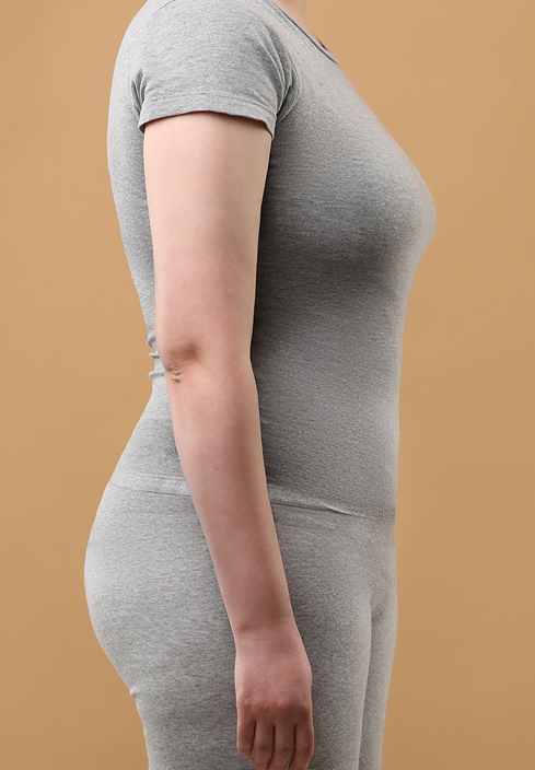 After profile of Sophia Lanes